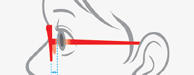 Types of nose pads and fitting results