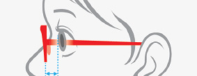 Types of nose pads and fitting results